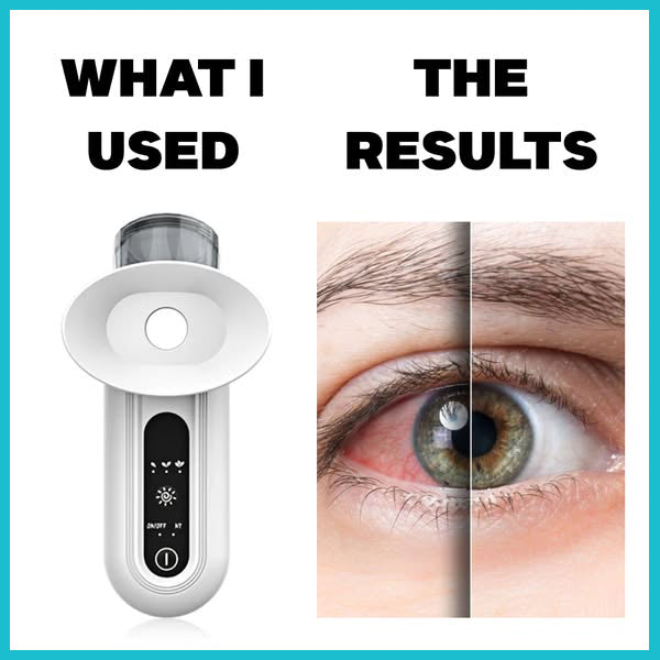 EyeRevital Steam Therapy Wand